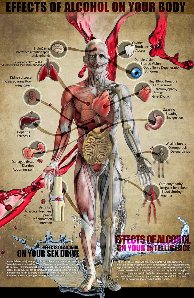 Addiction Recovery Infographics